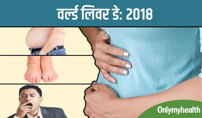 इन 6 संकेतों से पहचानें लिवर में जमा हो गई है गंदगी, डैमेज हो सकता है लिवर